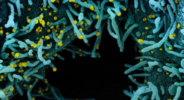 Novo SARS-CoV-2 de Coronavírus Micrografia eletrônica de varredura colorida de uma célula fortemente infectada com partículas do vírus SARS-CoV-2 (amarelo), isoladas de uma amostra de paciente. A área preta da imagem é espaço extracelular entre as células. Imagem capturada no NIAID Integrated Research Facility (IRF) em Fort Detrick, Maryland. Photo: NIAID/via Fotos Públicas.